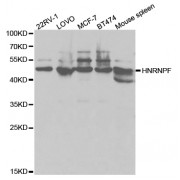 Western blot analysis of extracts of various cell lines, using HNRNPF antibody (abx004220) at 1/1000 dilution.