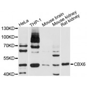 Western blot analysis of extracts of various cell lines, using CBX6 antibody (abx004236) at 1/1000 dilution.