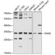 Western blot analysis of extracts of various cell lines, using SNAIL/SNAI1 antibody (abx004244) at 1/1000 dilution.