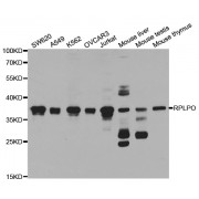 Western blot analysis of extracts of various cell lines, using RPLP0 antibody (abx004256) at 1/1000 dilution.