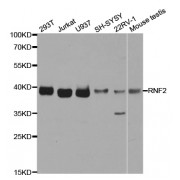 Western blot analysis of extracts of various cell lines, using RNF2 antibody (abx004262) at 1/1000 dilution.