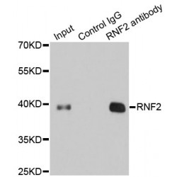 Ring Finger Protein 2 (RNF2) Antibody