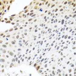 Exosome RNA Helicase MTR4 (MTR4/SKIV2L2) Antibody