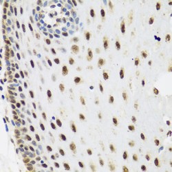 Exosome RNA Helicase MTR4 (MTR4/SKIV2L2) Antibody