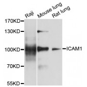 Western blot analysis of extracts of various cell lines, using ICAM1 antibody (abx004278) at 1/1000 dilution.