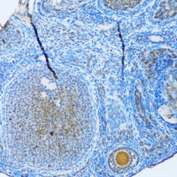 Microtubule-Associated Proteins 1A/1B Light Chain 3B (MAP1LC3B) Antibody