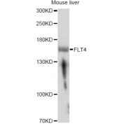 Western blot analysis of extracts of mouse liver, using FLT4 antibody (abx004284) at 1/1000 dilution.