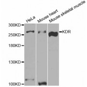 Western blot analysis of extracts of various cell lines, using KDR antibody (abx004288) at 1/1000 dilution.