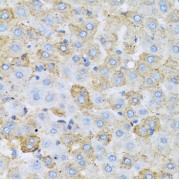 Immunohistochemistry of paraffin-embedded rat liver using APOC1 antibody (abx004304) at dilution of 1/100 (40x lens).
