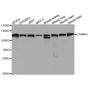 Western blot analysis of extracts of various cell lines, using CTNNA1 antibody (abx004308) at 1/1000 dilution.