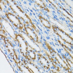 Catenin Alpha 1 (CTNNA1) Antibody