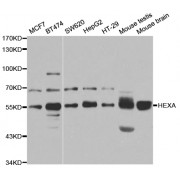 Western blot analysis of extracts of various cell lines, using HEXA antibody (abx004317) at 1/1000 dilution.