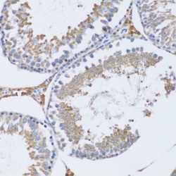 Tumor Necrosis Factor Ligand Superfamily Member 12 (TNFSF12) Antibody