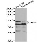Western blot analysis of extracts of various cell lines, using TRPV4 antibody (abx004329) at 1/1000 dilution.