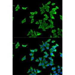 5-Hydroxytryptamine Receptor 2B (HTR2B) Antibody