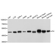 Western blot analysis of extracts of various cell lines, using FH antibody (abx004350) at 1/1000 dilution.
