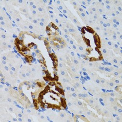 Growth Factor Receptor Bound Protein 2 (GRB2) Antibody