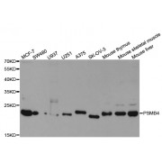 Western blot analysis of extracts of various cell lines, using PSMB4 antibody (abx004358) at 1/1000 dilution.