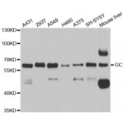 Western blot analysis of extracts of various cell lines, using GC antibody (abx004365) at 1/1000 dilution.