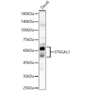 Western blot analysis of extracts of Daudi cell lysates (25 µg/lane), using Beta-Galactoside Alpha-2,6-Sialyltransferase 1 (ST6GAL1) Antibody (1/2000 dilution) followed by <a href="https://www.abbexa.com/index.php?route=product/search&search=abx005548" target="_blank">abx005548</a> - Goat Anti-Rabbit IgG, H+L (1/10000 dilution) and 3% non-fat dry milk in TBST for blocking.