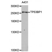 Western blot analysis of extracts of A-431 cells, using TP53BP1 antibody (abx004406) at 1/1000 dilution.
