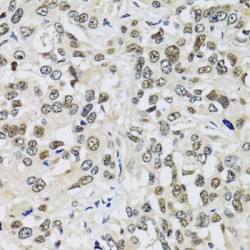 Tumor Protein P53 Binding Protein 1 (TP53BP1) Antibody