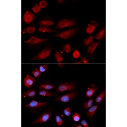 Tumor Protein P53 Binding Protein 1 (TP53BP1) Antibody