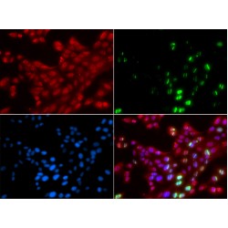 Tumor Protein P53 Binding Protein 1 (TP53BP1) Antibody