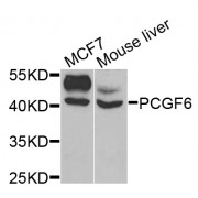 Western blot analysis of extracts of various cell lines, using PCGF6 antibody (abx004408) at 1/1000 dilution.