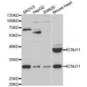 Western blot analysis of extracts of various cell lines, using KCNJ11 antibody (abx004413) at 1/1000 dilution.