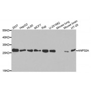 Western blot analysis of extracts of various cell lines, using ANP32A antibody (abx004416) at 1/1000 dilution.