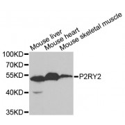 Western blot analysis of extracts of various cell lines, using P2RY2 antibody (abx004427) at 1/1000 dilution.