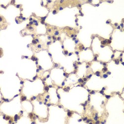 CXXC-Type Zinc Finger Protein 1 (CXXC1) Antibody