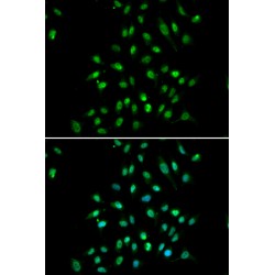 CXXC-Type Zinc Finger Protein 1 (CXXC1) Antibody