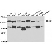 Western blot analysis of extracts of various cell lines, using DDX20 antibody (abx004457) at 1/1000 dilution.