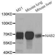 Western blot analysis of extracts of various cell lines, using NAB2 antibody (abx004467) at 1/1000 dilution.
