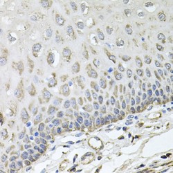 Mitochondrial Rho GTPase 1 (RHOT1) Antibody