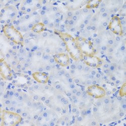 Mitochondrial Ribosomal Protein S30 (MRPS30) Antibody