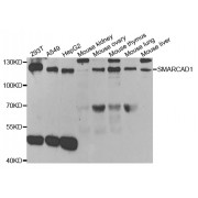 Western blot analysis of extracts of various cell lines, using SMARCAD1 antibody (abx004487) at 1/1000 dilution.
