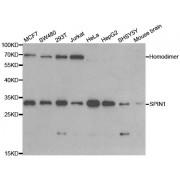 Western blot analysis of extracts of various cell lines, using SPIN1 antibody (abx004490) at 1/1000 dilution.