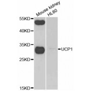 Western blot analysis of extracts of various cell lines, using UCP1 antibody (abx004494) at 1/1000 dilution.