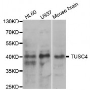 Western blot analysis of extracts of various cell lines, using NPRL2 antibody (abx004496) at 1/1000 dilution.