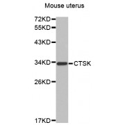 Western blot analysis of extracts of mouse uterus, using CTSK antibody (abx004504).