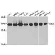 Western blot analysis of extracts of various cell lines, using SBDS antibody (abx004508) at 1/1000 dilution.