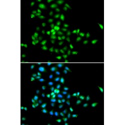 Ribosome Maturation Protein SBDS (SBDS) Antibody