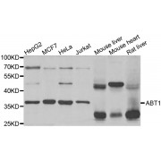 Western blot analysis of extracts of various cell lines, using ABT1 antibody (abx004524) at 1/1000 dilution.