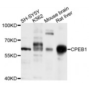 Western blot analysis of extracts of various cell lines, using CPEB1 antibody (abx004530) at 1/1000 dilution.