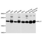Western blot analysis of extracts of various cell lines, using RPL17 antibody (abx004550) at 1/1000 dilution.
