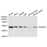 Western blot analysis of extracts of various cell lines, using PABPN1 antibody (abx004649) at 1/1000 dilution.