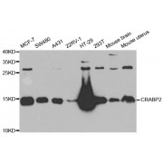 Western blot analysis of extracts of various cell lines, using CRABP2 antibody (abx004683) at 1/1000 dilution.